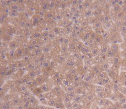 Pyruvate Dehydrogenase Kinase Isozyme 3 (PDK3) Mouse Polyclonal Antibody