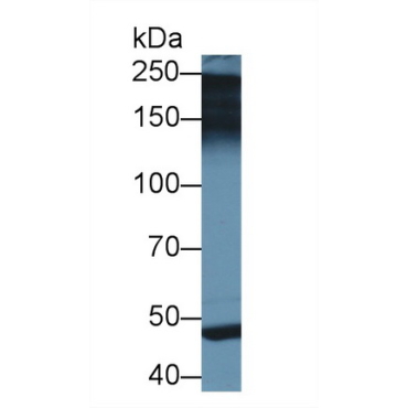 Pappalysin 2 (PAPPA2) Human Polyclonal Antibody
