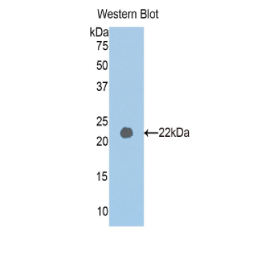 Pappalysin 2 (PAPPA2) Human Polyclonal Antibody