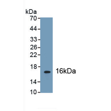 Glucagon Like Peptide 1 Receptor (GLP1R) Human Polyclonal Antibody