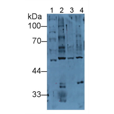 Heat Shock 70kDa Protein 14 (HSPA14) Human Polyclonal Antibody