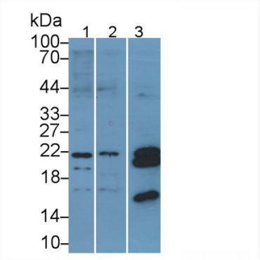 Heat Shock Protein Beta 7 (HSPb7) Human Polyclonal Antibody