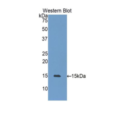 Heat Shock 105kDa/110kDa Protein 1 (HSPH1) Human Polyclonal Antibody