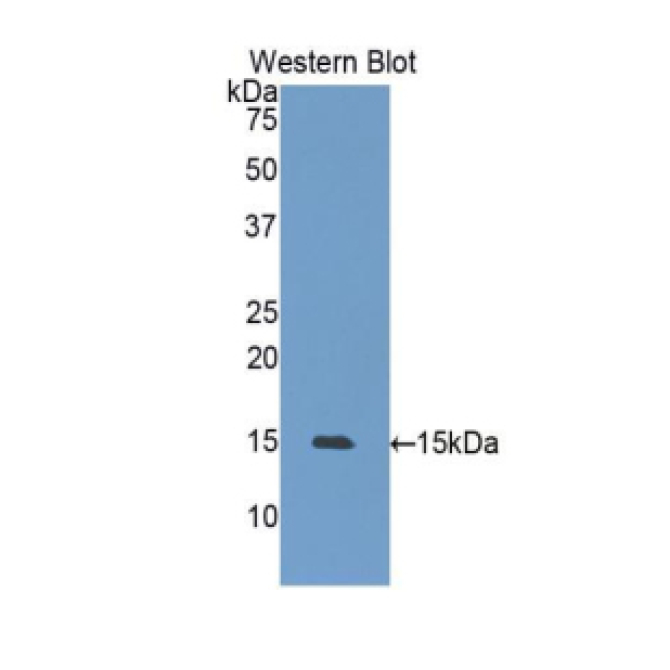 Heat Shock 105kDa/110kDa Protein 1 (HSPH1) Human Polyclonal Antibody