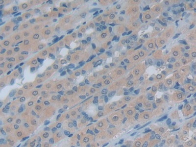 Heat Shock 105kDa/110kDa Protein 1 (HSPH1) Rat Polyclonal Antibody