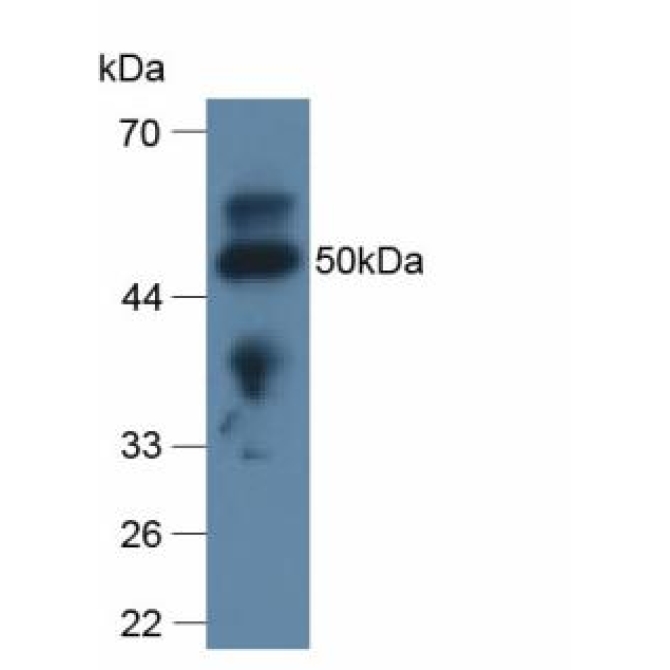 Apolipoprotein L2 (APOL2) Human Polyclonal Antibody