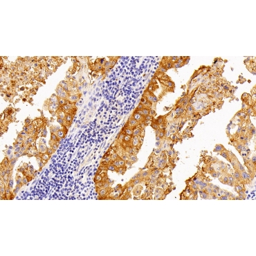 Surfactant Associated Protein A2 (SPA2) Human Polyclonal Antibody