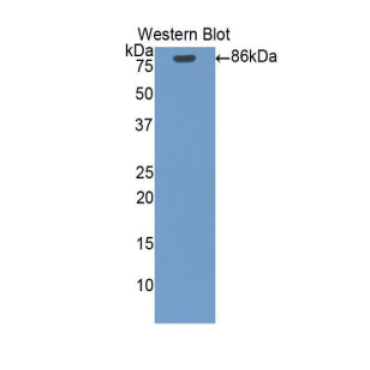 Heat Shock Protein 90kDa Alpha B1 (HSP90aB1) Human Polyclonal Antibody