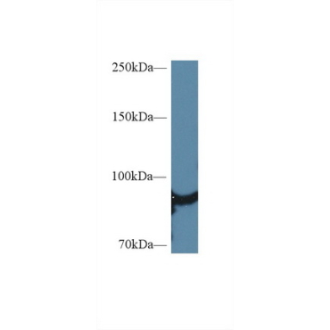 Heat Shock Protein 90kDa Alpha A1 (HSP90aA1) Human Polyclonal Antibody