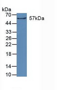 Cytochrome P450 27B1 (CYP27B1) Human Polyclonal Antibody