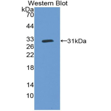 Cytochrome P450 27B1 (CYP27B1) Mouse Polyclonal Antibody