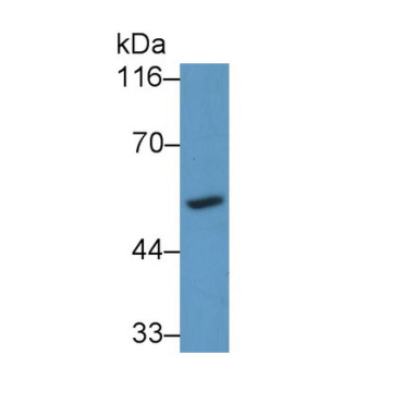 Cytochrome P450 26A1 (CYP26A1) Human Polyclonal Antibody