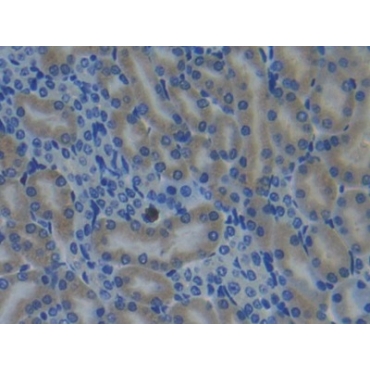 Cytochrome P450 26A1 (CYP26A1) Mouse Polyclonal Antibody