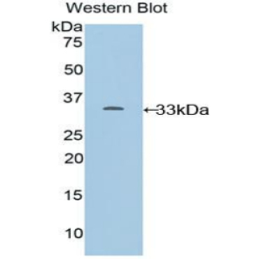 Cytochrome P450 24A1 (CYP24A1) Mouse Polyclonal Antibody