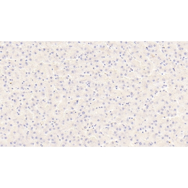 Phosphoenolpyruvate Carboxykinase 2, Mitochondrial (PCK2) Human Polyclonal Antibody