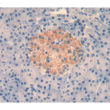 Protein Tyrosine Phosphatase, Non Receptor Type 3 (PTPN3) Human Polyclonal Antibody