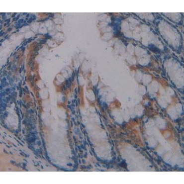 Protein Tyrosine Phosphatase, Non Receptor Type 3 (PTPN3) Mouse Polyclonal Antibody