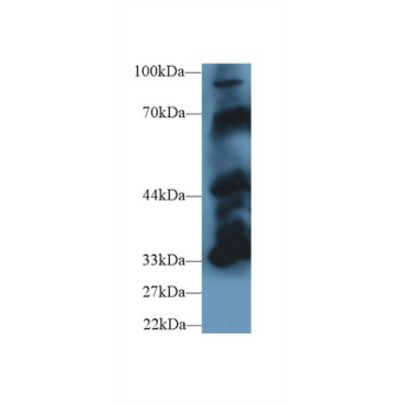 Protein Tyrosine Phosphatase, Non Receptor Type 5 (PTPN5) Mouse Polyclonal Antibody