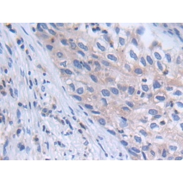 Protein Tyrosine Phosphatase, Non Receptor Type 6 (PTPN6) Human Polyclonal Antibody