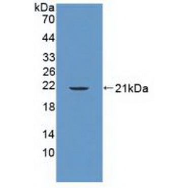 Protein Tyrosine Phosphatase, Non Receptor Type 13 (PTPN13) Human Polyclonal Antibody