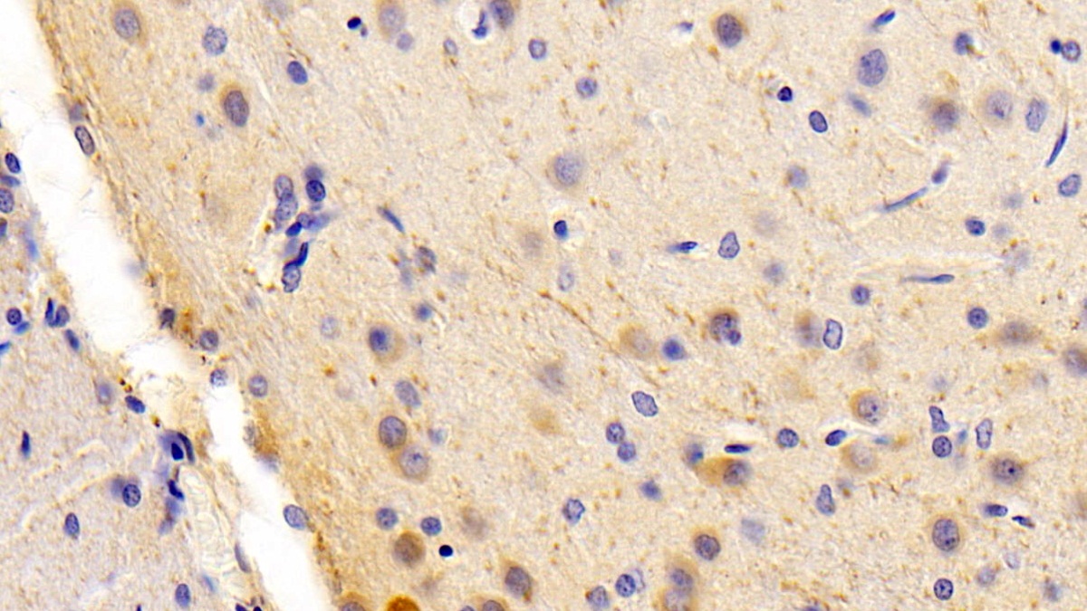 Protein Tyrosine Phosphatase, Non Receptor Type 13 (PTPN13) Rat Polyclonal Antibody