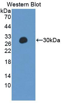 Protein Tyrosine Phosphatase, Non Receptor Type 14 (PTPN14) Rat Polyclonal Antibody