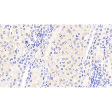 Protein Tyrosine Phosphatase, Non Receptor Type 21 (PTPN21) Human Polyclonal Antibody
