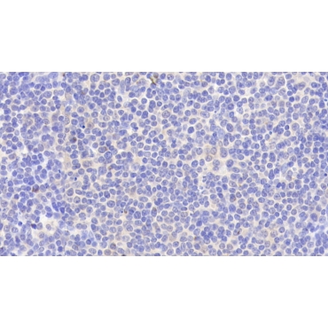 Protein Tyrosine Phosphatase, Non Receptor Type 22 (PTPN22) Human Polyclonal Antibody