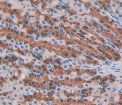Protein Tyrosine Phosphatase, Non Receptor Type 22 (PTPN22) Rat Polyclonal Antibody