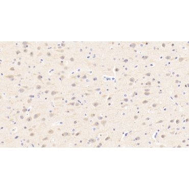 Protein Tyrosine Phosphatase Receptor Type A (PTPRA) Human Polyclonal Antibody