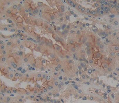 Protein Tyrosine Phosphatase Receptor Type E (PTPRE) Human Polyclonal Antibody