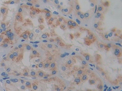 Protein Tyrosine Phosphatase Receptor Type Q (PTPRQ) Human Polyclonal Antibody