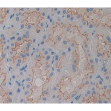 Protein Tyrosine Phosphatase, Mitochondrial 1 (PTPMT1) Human Polyclonal Antibody