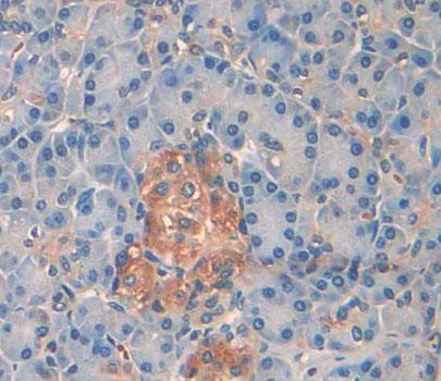Protein Tyrosine Phosphatase Receptor Type N2 (PTPRN2) Human Polyclonal Antibody