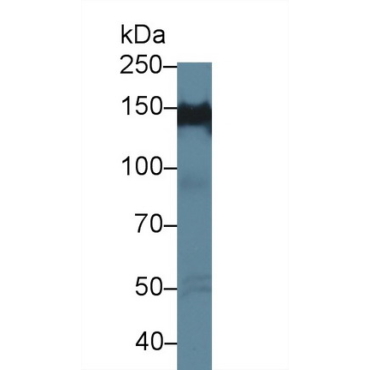 Protein Tyrosine Phosphatase F Interacting Protein 1 (PPFIA1) Human Polyclonal Antibody