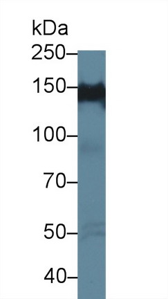 Protein Tyrosine Phosphatase F Interacting Protein 1 (PPFIA1) Human Polyclonal Antibody