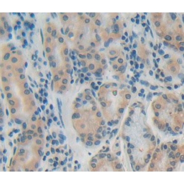 Protein Tyrosine Phosphatase Type IVA 1 (PTP4A1) Human Polyclonal Antibody