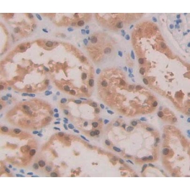ATP Binding Cassette Transporter A2 (ABCA2) Human Polyclonal Antibody