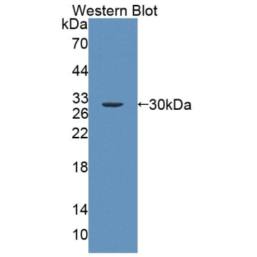 ATP Binding Cassette Transporter A2 (ABCA2) Mouse Polyclonal Antibody