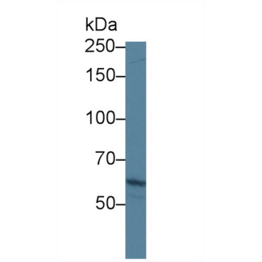 ATP Binding Cassette Transporter A3 (ABCA3) Human Polyclonal Antibody