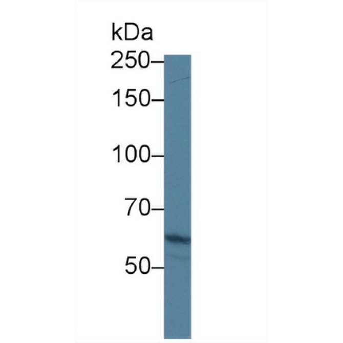 ATP Binding Cassette Transporter A3 (ABCA3) Human Polyclonal Antibody