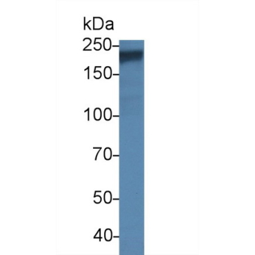 ATP Binding Cassette Transporter A4 (ABCA4) Human Polyclonal Antibody