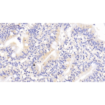 ATP Binding Cassette Transporter E1 (ABCE1) Human Polyclonal Antibody