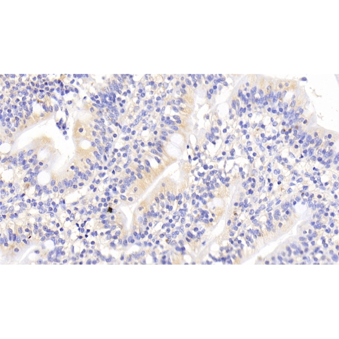 ATP Binding Cassette Transporter E1 (ABCE1) Human Polyclonal Antibody