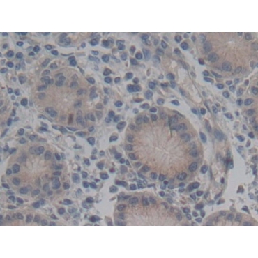 ATP Binding Cassette Transporter C2 (ABCC2) Human Polyclonal Antibody
