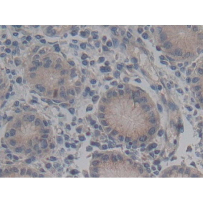 ATP Binding Cassette Transporter C2 (ABCC2) Human Polyclonal Antibody