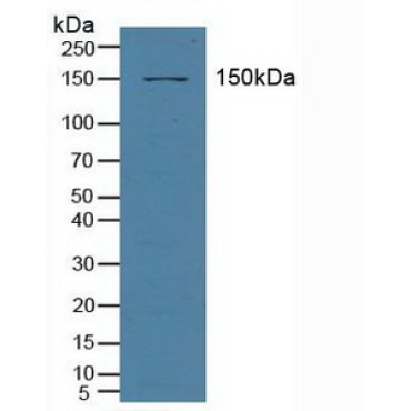 ATP Binding Cassette Transporter C3 (ABCC3) Human Polyclonal Antibody