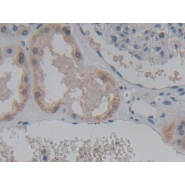 ATP Binding Cassette Transporter C8 (ABCC8) Human Polyclonal Antibody