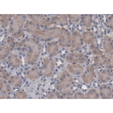 ATP Binding Cassette Transporter C11 (ABCC11) Mouse Polyclonal Antibody