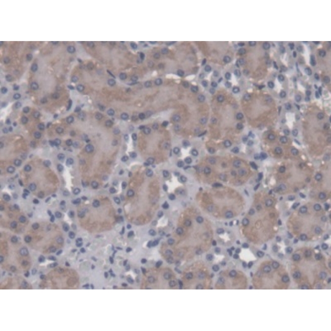 ATP Binding Cassette Transporter C11 (ABCC11) Mouse Polyclonal Antibody